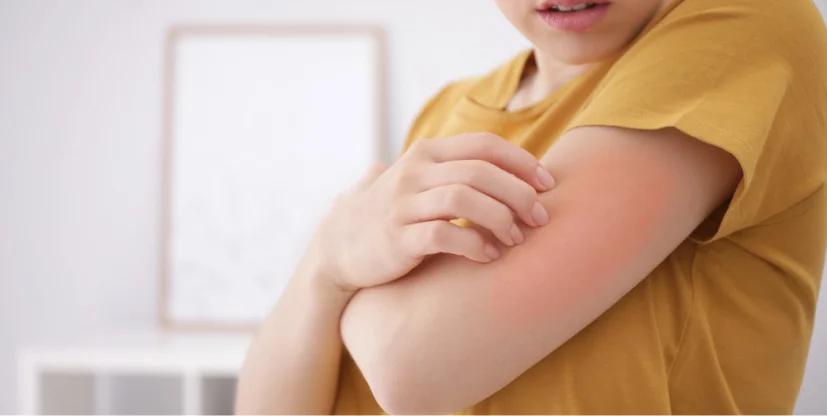 Allergy Control Treatment Services in Staten Island